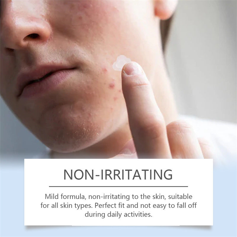 Restly Night Patch – Hydrocolloid Pimple Patches