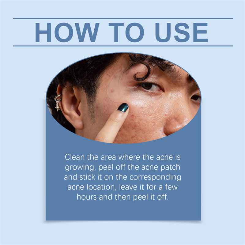 Restly Night Patch – Hydrocolloid Pimple Patches